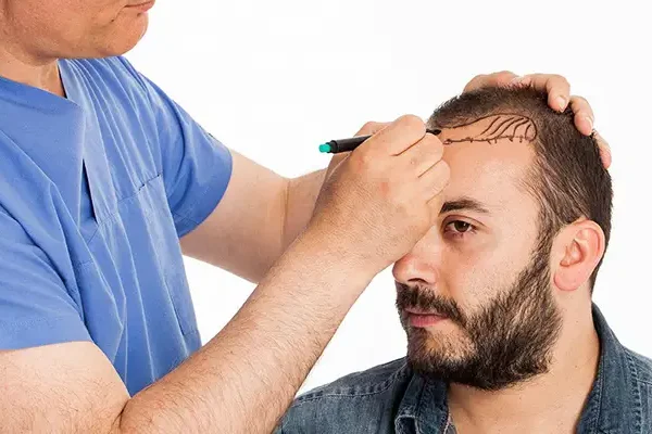 Dhi Transplantation Cheveux Turquie