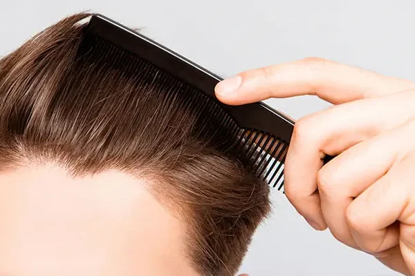 Greffe de Cheveux Séropositifs