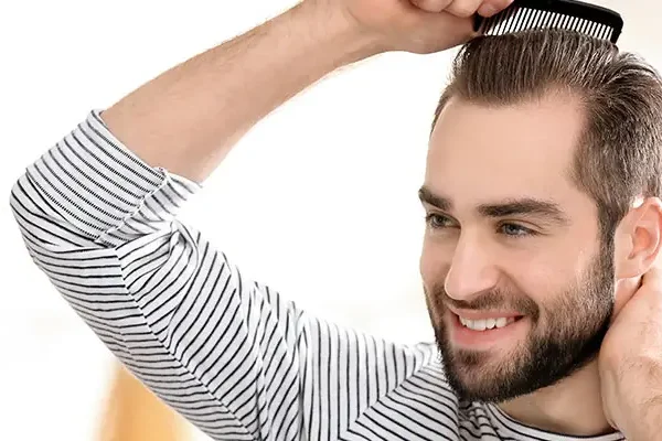 Greffe de Cheveux