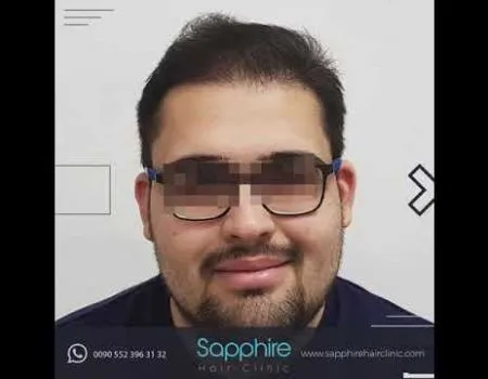 Sapphire Hair Clinic