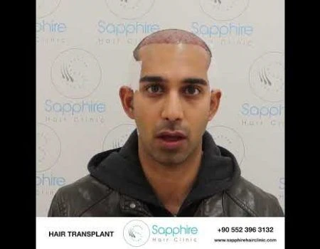 Sapphire Hair Clinic