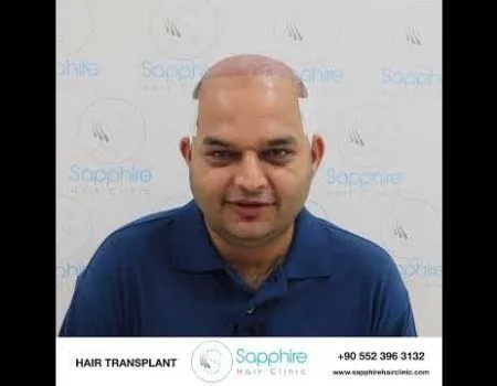 Sapphire Hair Clinic
