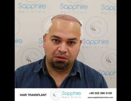 Sapphire Hair Clinic